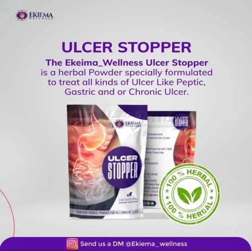 ulcer stopper 1