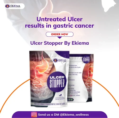 ulcer stopper 2