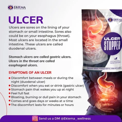 ulcer stopper 5